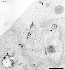 Why study from magnet brains? Endosome Wikipedia