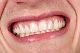 What to do if i dipped once 3 days ago and my gums arent sore or red anymore but i have a sore where i put the dip. Tips For Soothing Sore Gums