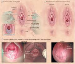 Humor us for a sec: Female Prepubertal Genital Anatomy Download Scientific Diagram