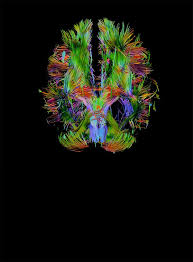 Последние твиты от michael tyszka (@michaeltyszka1). Five From Caltech Receive Nih Brain Grants Www Caltech Edu