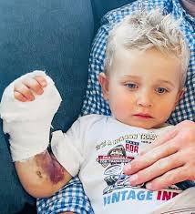 Chlapček po uhryznutí hadom takmer zomrel: Keď sa z toho dostal, prišla  ďalšia ťažká rana