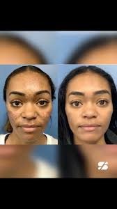 You hear that @deezlegetsgrammys? These millenials have you and Lil Wayne  to blame for these wrinkles. 🥴🧓🏻 #amilli #awrinkle #laughlines