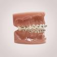 Braces Treatment in Prabhadevi product image