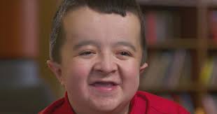 He's best known as the spokesperson for shriners hospitals for children and for appearing in their commercials. Alec S Mission Cbs News