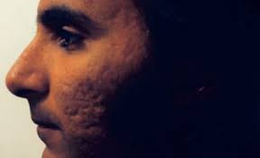 Meet Gilbert Holguin