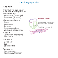 Image result for Cardiomyopathy