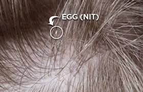 Image result for what do lice look like in dog fur