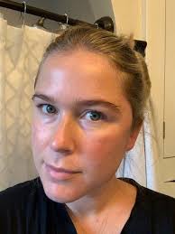 Versed Exfoliator Review