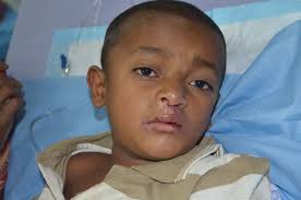 Rotaplast Missions: 2014 Sylhet, Bangladesh