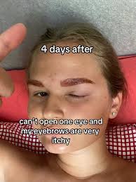 Eyebrow Tint Allergy Remedy