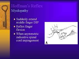 Hoffman s sign in cervical stenosis. Common Cervical Spine Disorders Diagnosis And Treatment Wayne