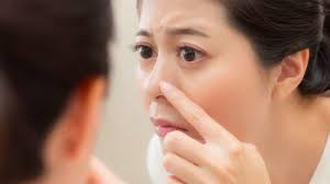 Miếng dán lột mụn có thực sự tốt? Cách dùng miếng lột mụn đúng cách