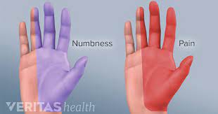 Carpal Tunnel Syndrome Vs Cervical Radiculopathy