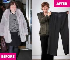 Boyle has managed to lose 50 pounds after readjusting her lifestyle and working out. Susan Boyle Weight Loss How Did She Lose Weight Surgery