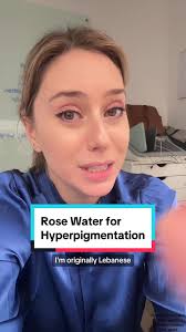 Rose Water for Hyperpigmentation Treatment