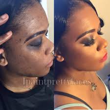 How to cover acne, scarring, and discoloration **Base Face **