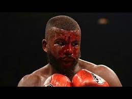 Badou the ripper jack was born october 31, 1983 in stockholm, sweden to a gambian father and swedish mother. Badou Jack Suffers Tomahawk Like Injury In The 7th Still Finishes The Fight Warrior Ldbc Youtube