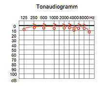 Audiogram Wikipedia