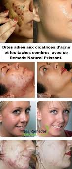 Pin On Beaute
