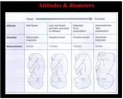 Image result for Brow Presentation