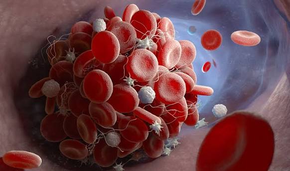 Understand the Reason Behind the Blood Clotting | Weljii