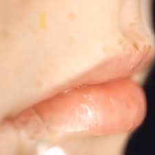 Does It Work See The Results Video Beauty Skin Care Health And Beauty Tips Makeup Skin Care