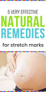 5 Highly Effective Natural Remedies For Stretch Marks Imperfectly Perfect Mama