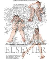 Image result for Perthes Test