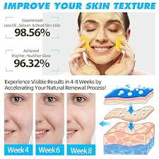 Amazon.com: Turmeric Cleansing Pads for Face,60PCS Turmeric Cleansing Pads  for Dark Spots,Exfoliating for Face and Body with Vitamin B5 Vitamin C for  Body's Skin : Beauty & Personal Care