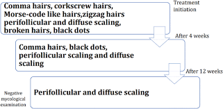 Trichoscopy Of Tinea Capitis A Systematic Review Springerlink