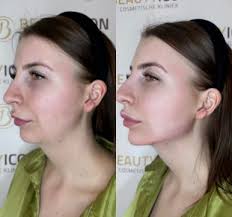 Beauty Icon Almere in Almere-Buiten