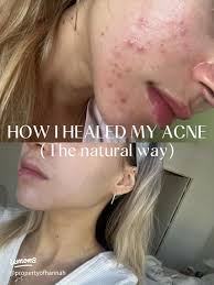 20 top Organic Skincare Therapy ideas in 2024