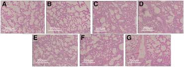 To initially assess this in both small and large avian lung models, chicken (gallus gallus domesticus) and emu. Mesenchymal Stromal Cell Treatment Prevents H9n2 Avian Influenza Virus Induced Acute Lung Injury In Mice Stem Cell Research Therapy Full Text