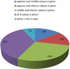 pie chart showing residual calculus according to stone