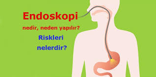 Endoskopi Nedir Neden Ve Nasil Yapilir Riskleri Nelerdir