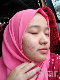 Ikuti perkongsian puan raja amanina melalui laman nak masak apa hari ni. Tengok Testimoni Pengguna Lain Kulit Mereka Jadi Cantik Gadis Selamba Kongsi Foto Muka Penuh Jerawat Selepas Guna Produk Dicadangkan Makcik Viral Mstar