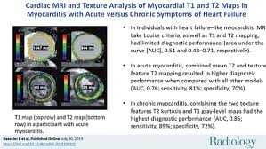 Clinical presentation clinical presentation is variable in severity, ranging from asymptomatic to. Cardiac Mri And Texture Analysis Of Myocardial T1 And T2 Maps In Myocarditis With Acute Versus Chronic Symptoms Of Heart Failure Pd Dr Med Bettina Baessler