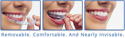 Oct 28, 2020 · invisalign®. Straighten Your Teeth With Invisalign Maple Ridge Orthodontist