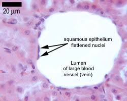 The endothelium that lines the blood vessels may be seen on almost any slide of sectioned tissue, e.g. Epithelia The Histology Guide