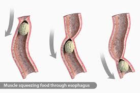 A feeling of something stuck in the throat may actually be the result of the abnormal positioning of the tissues within the esophagus. Webmd Su Twitter Your Esophagus Sends Food From Your Throat To Your Stomach Through Tiny Muscle Squeezes While Rare Sometimes These Muscles Tighten Up When They Shouldn T What To Know About Esophageal
