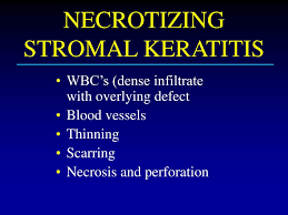 In the united states, there are approximately 60,000 cases of new and recurrent cases of hsv keratitis yearly. Ppt Diagnosis And Treatment Of Herpes Simplex Keratitis Update Powerpoint Presentation Id 1830592