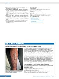 The state department makes headlines on a daily basis for its policies and involvement in foreign affairs. Psoriasiform Dermatitis During Infliximab Therapy For Ulcerative Colitis 25 09 2020