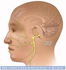 Bell's palsy can strike anyone at any age. Bell S Palsy Facial Nerve Disorders