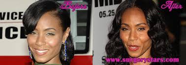 She acknowledged in a 2018 interview with today that she had gotten steroid . Jada Pinkett Smith Plastic Surgery Before And After Pic