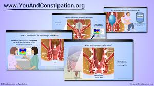 Image result for Defecation