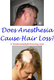 Acute Hair Loss Causes Stress Hair Loss Hair Loss Pills Hair Loss After Baby