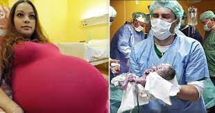 Twins and triplets are sufficiently common to have their own separate articles. Woman Told She S Pregnant With Twins Then Gives Birth To Quintuplets