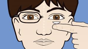 Put a bunch of cleaner/rewetting drops in. What To Know If Your Child Wants Contact Lenses Fda