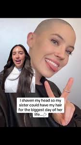 I Shaved My Head So My Sister Could Have My Hair