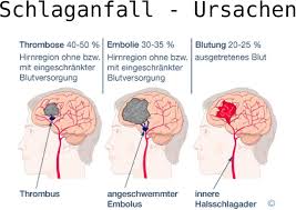 595 x 392 gif 60 кб. Blutversorgung Des Gehirns Pdf Kostenfreier Download